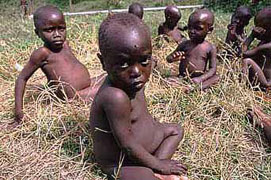 Niños con el vientre hinchado por desnutrición
